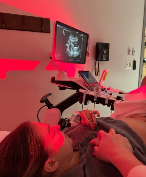 An IVF monitoring appointment